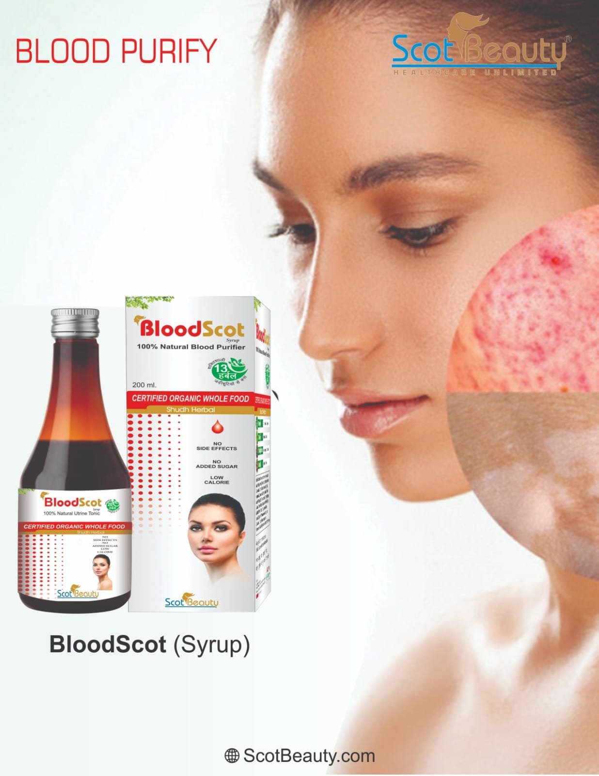 Bloodscott